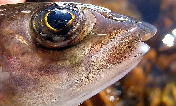 User submitted picture: Lens in the eye